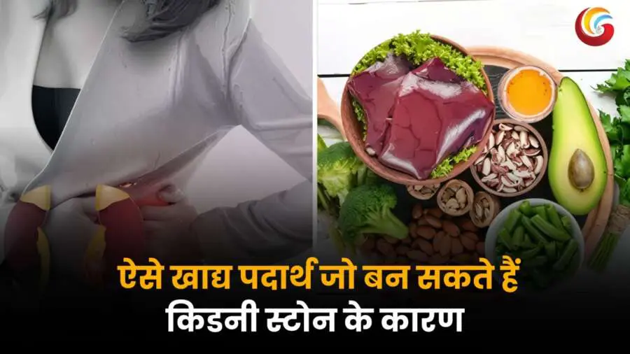 किडनी स्टोन का कारण बनने वाले खाद्य पदार्थ जैसे पालक, बीन्स, एवोकाडो, ड्राई फ्रूट्स और रेड मीट की तस्वीर।