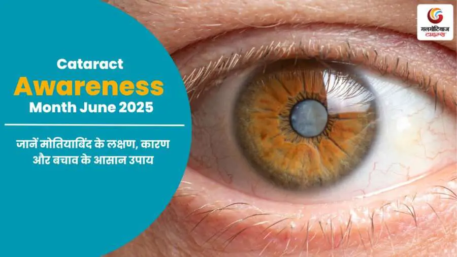 Cataract Awareness Month June 2025: जानें मोतियाबिंद के लक्षण, कारण और बचाव के आसान उपाय इस जानकारीपूर्ण पोस्ट में.