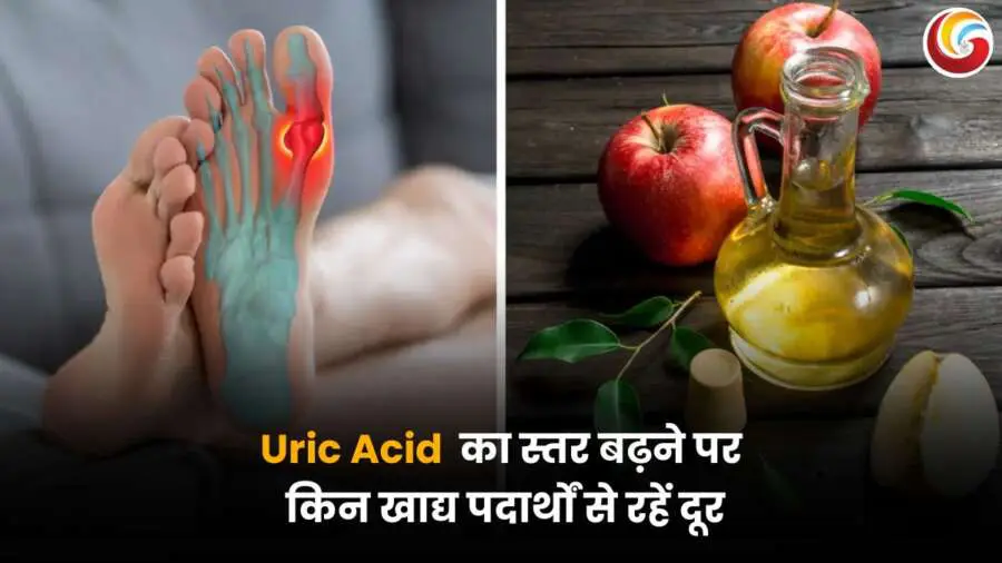 High Uric Acid: गठिया और यूरिक एसिड के कारण अंगूठे में सूजन और दर्द, साथ में सेब और सिरके जैसी संभावित ट्रिगर फूड्स की छवि.