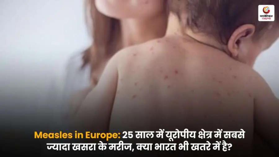 Measles in Europe: 25 साल में यूरोप में खसरे के सबसे ज्यादा मामले, क्या भारत पर भी संक्रमण का खतरा मंडरा रहा है? जानिए पूरी जानकारी.