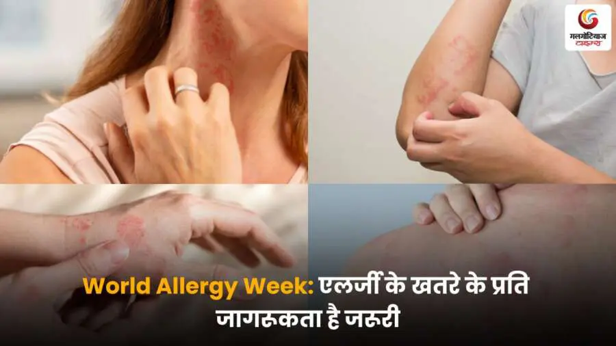 एलर्जी जागरूकता सप्ताह और उससे जुड़ी जरूरी जानकारी