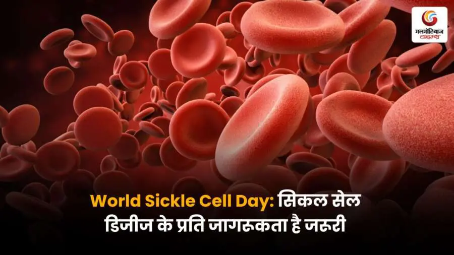 सिकल सेल डिजीज के बारे में जागरूकता बढ़ाने का संदेश – World Sickle Cell Day