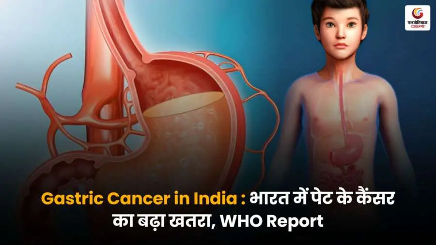 Gastric Cancer in India को लेकर WHO की चेतावनी वाली रिपोर्ट