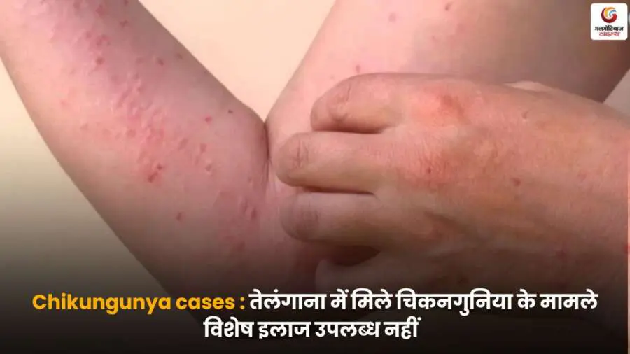तेलंगाना में Chikungunya cases और इलाज की कमी की स्थिति.