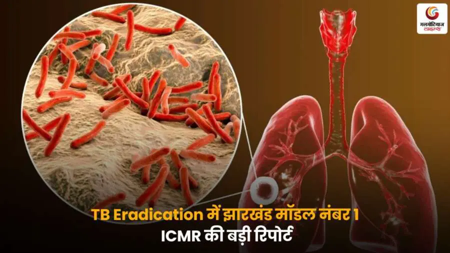 TB Eradication में झारखंड मॉडल नंबर 1, ICMR की रिपोर्ट.