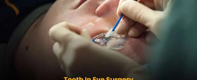 Tooth In Eye Surgery से महिला की आंखों की लौटी दृष्टि.
