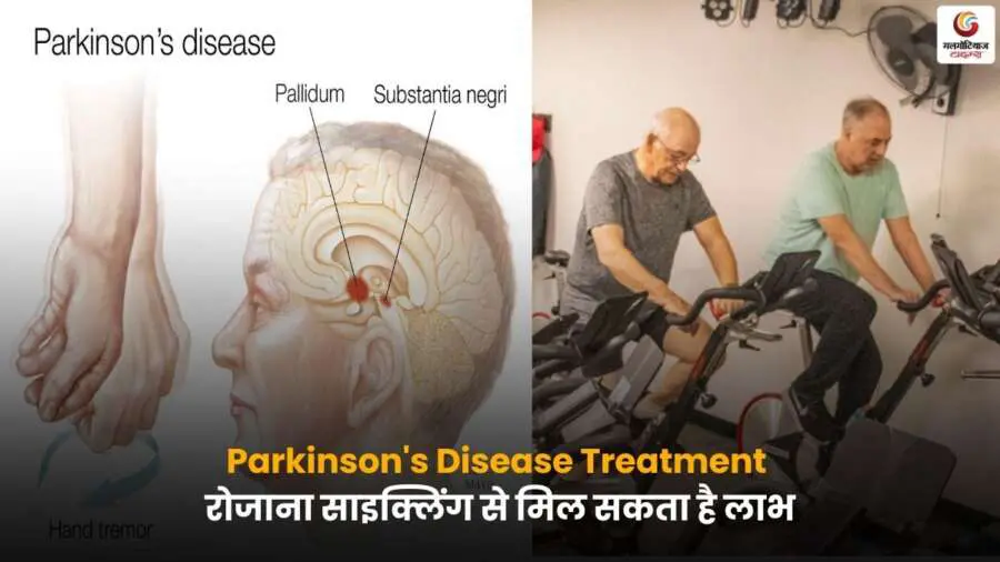 Parkinson's Disease Treatment में साइक्लिंग से लाभ दिखाती तस्वीर.