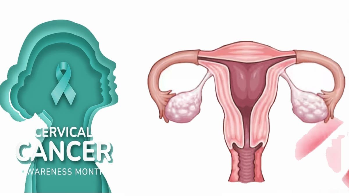 Cervical Cancer