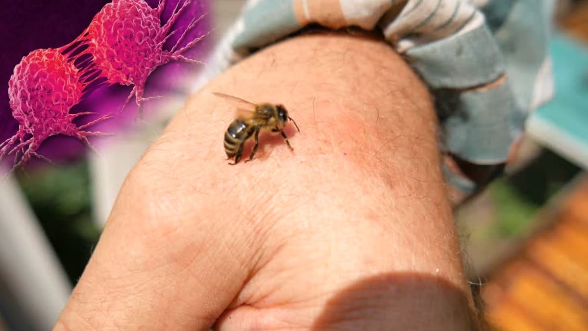 Honey bee sting for Cancer