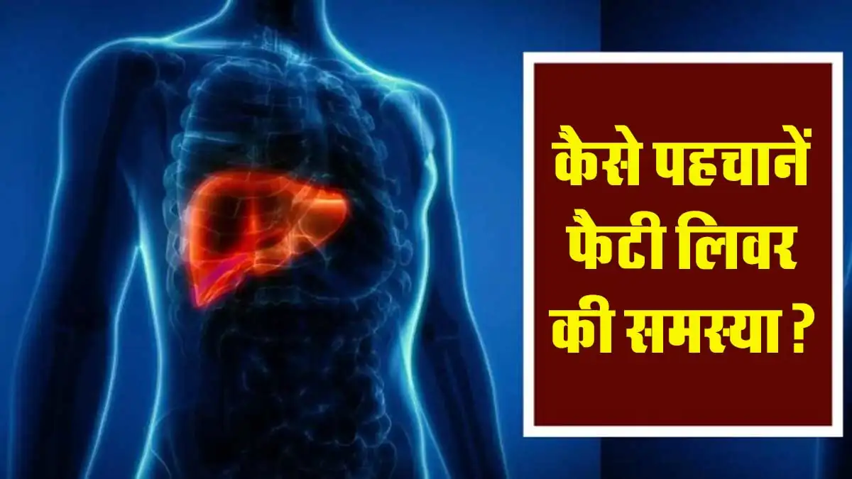 Fatty liver signs: Ghar par asani se fatty liver ke lakshan pehchaniye