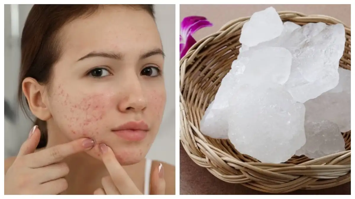 Alum For Dark Spots