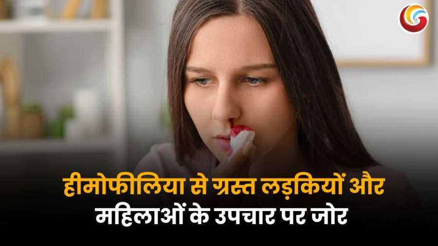 World Hemophilia Day 2025 पर हीमोफीलिया से पीड़ित लड़की नाक से रक्तस्राव के दौरान टिशू से खून साफ करते हुए.