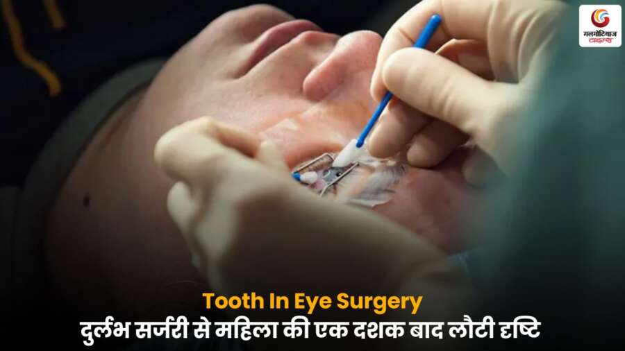 Tooth In Eye Surgery से महिला की आंखों की लौटी दृष्टि.
