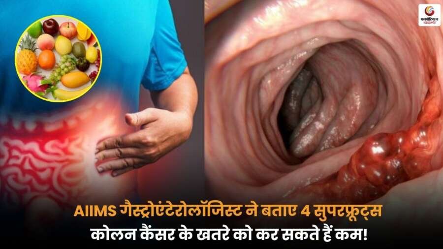 AIIMS ने Colon Cancer से बचाव के लिए 4 सुपरफ्रूट्स बताए, स्वास्थ्य के लिए फायदेमंद.