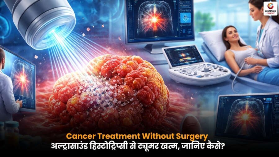 अल्ट्रासाउंड हिस्टोट्रिप्सी से बिना सर्जरी कैंसर ट्यूमर का इलाज करते डॉक्टर का दृश्य